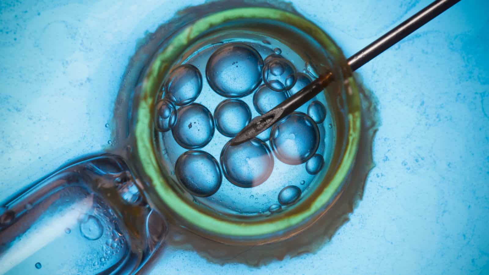 IVF close up