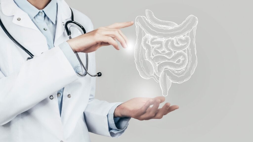 doctor holding image of colon. 