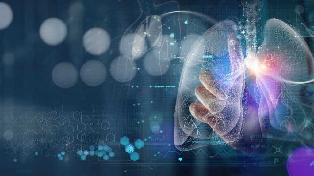 AI medical diagnostic.