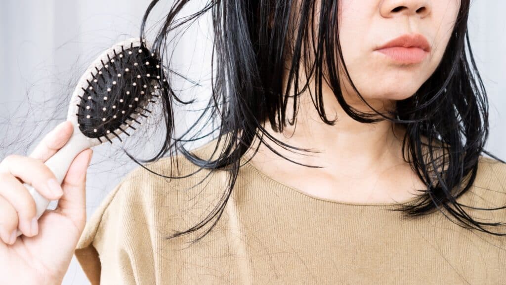 Hair loss.