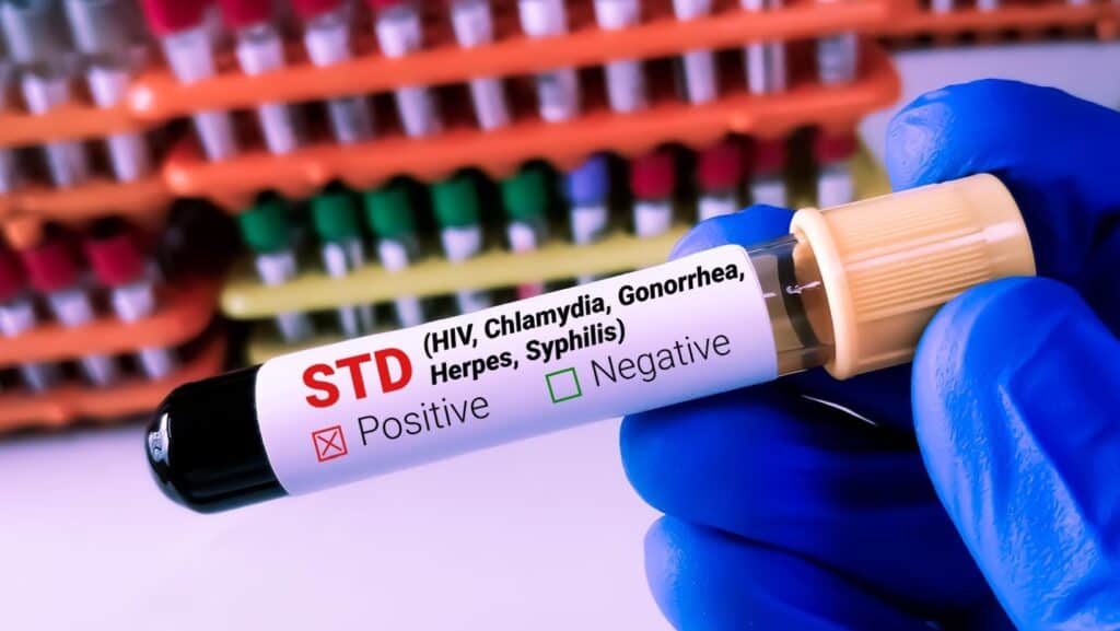 STD.