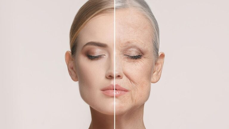 facelift.