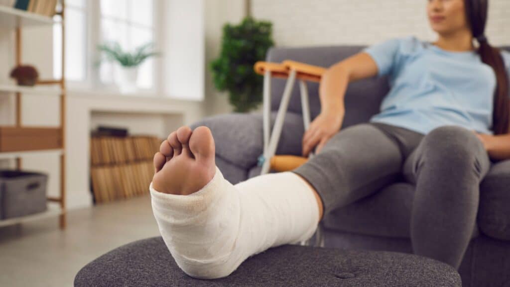 leg in cast.