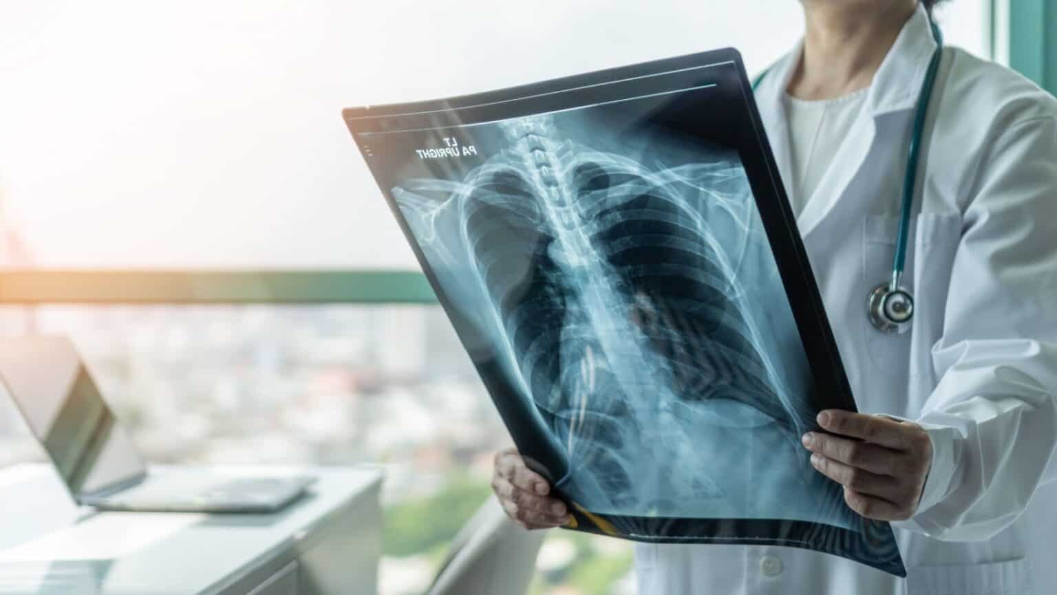 9 Hidden Dangers of Inhaling Helium That Could Put Your Life at Risk ...