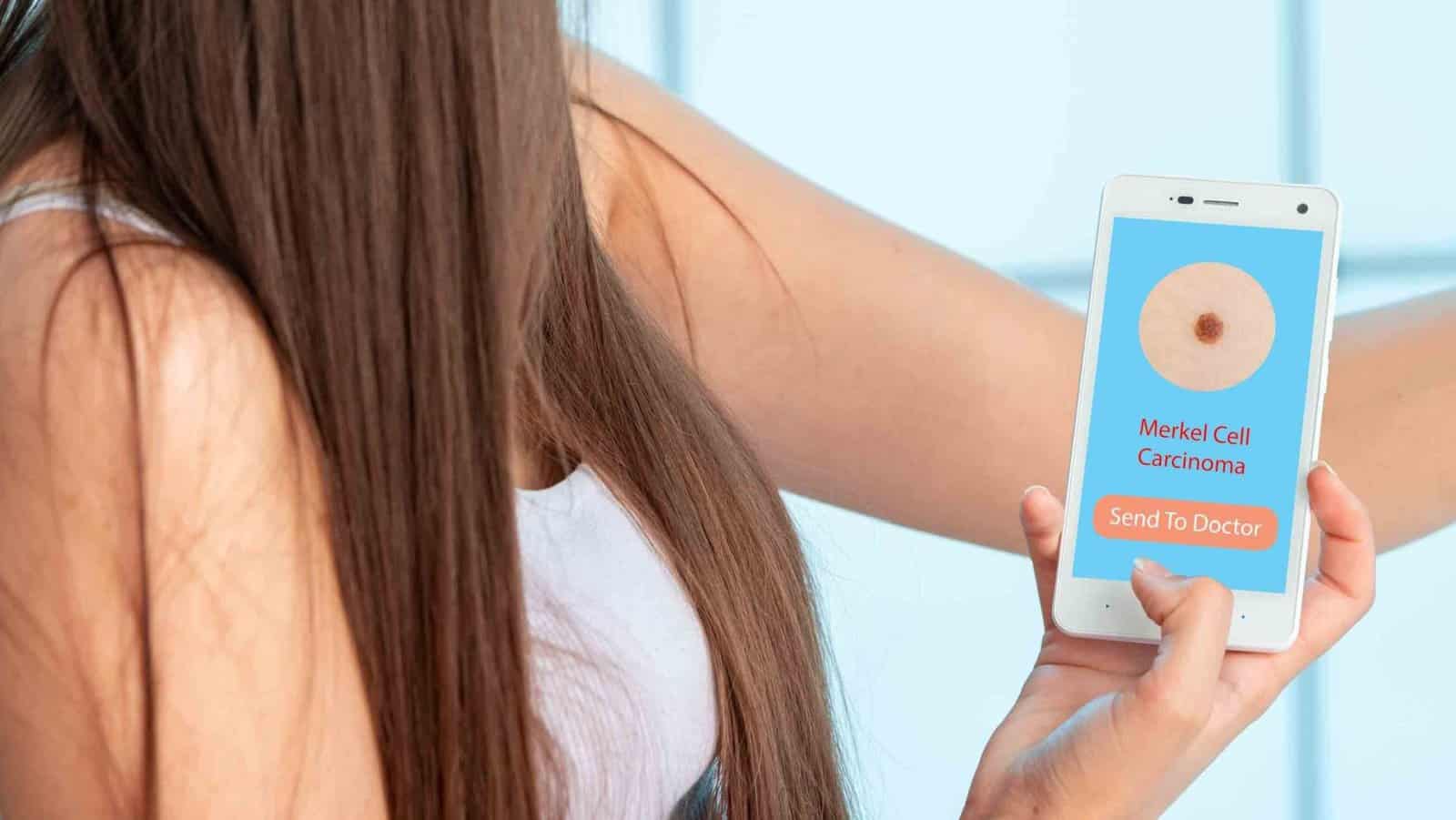 Merkel Cell Carcinoma: Rare but aggressive skin cancer that usually appears as a painless, firm bump. High degree of danger.