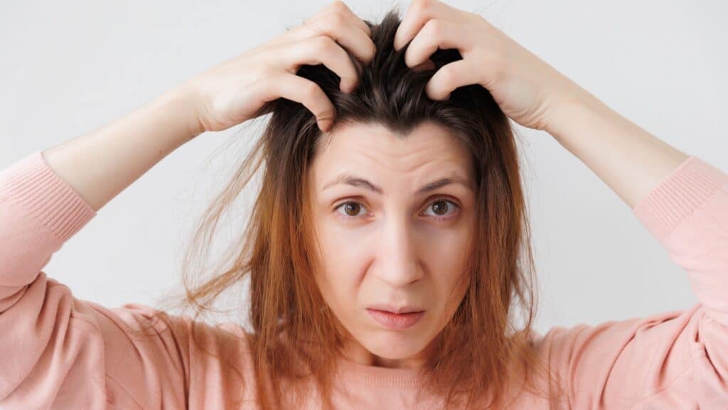 scalp irritation.