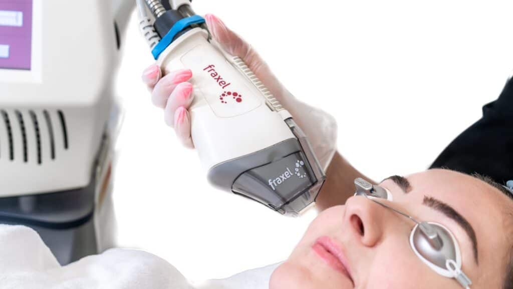Fraxel laser.