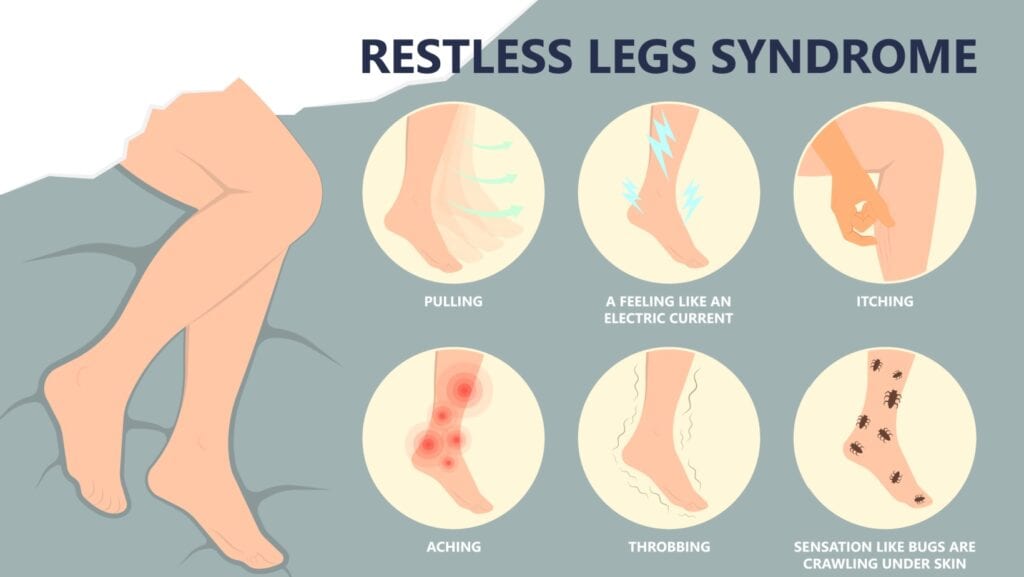 Restless leg syndrome.