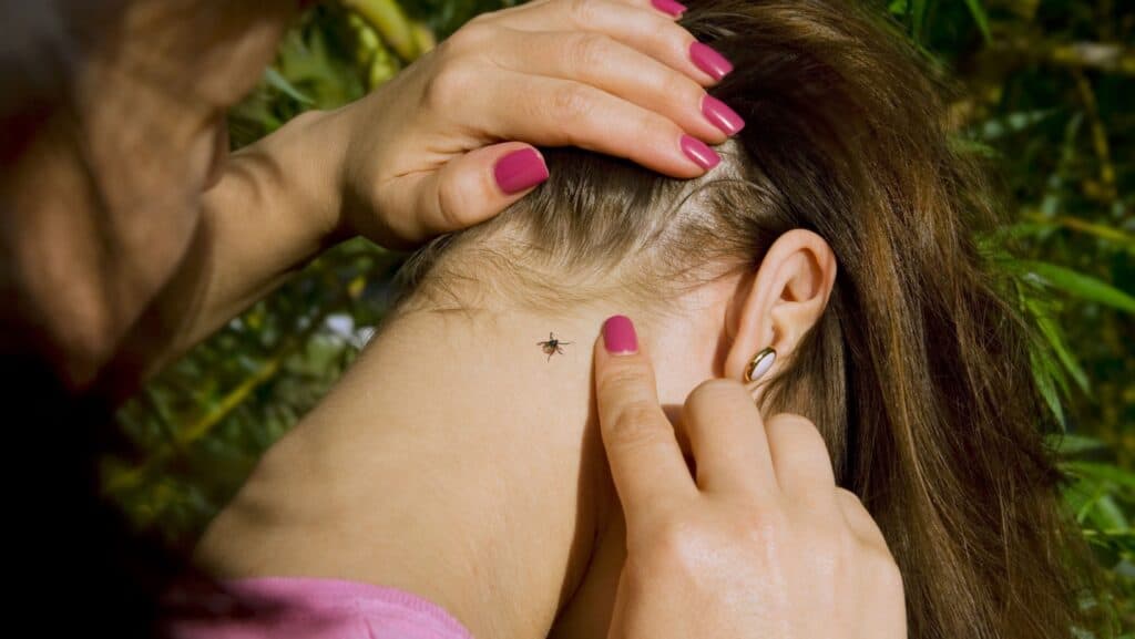 tick on girl's neck.