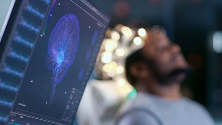 sleep brain study.