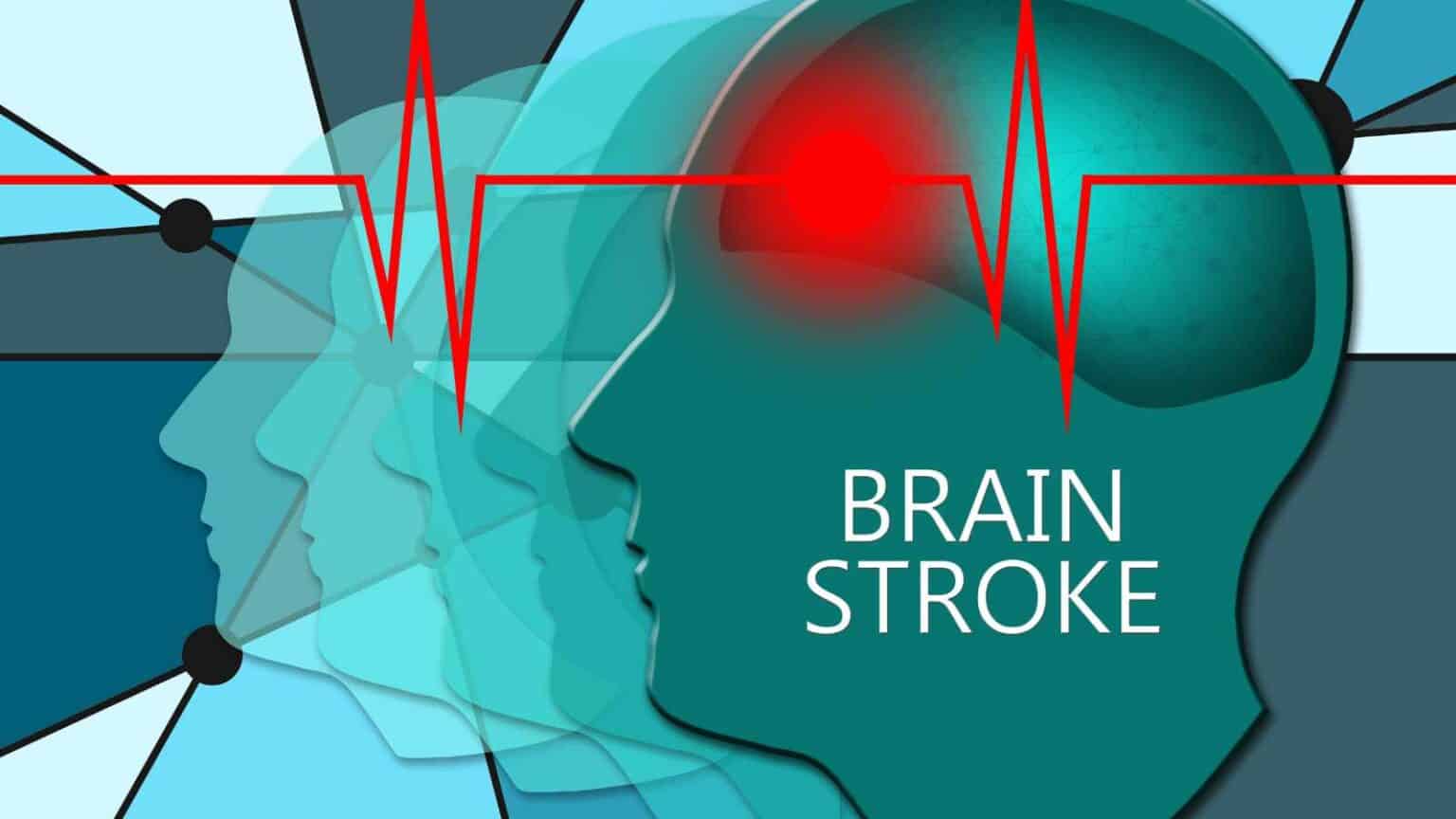 Hidden Stroke Risks: How Sleep Apnea and Gum Disease Could Put Your ...