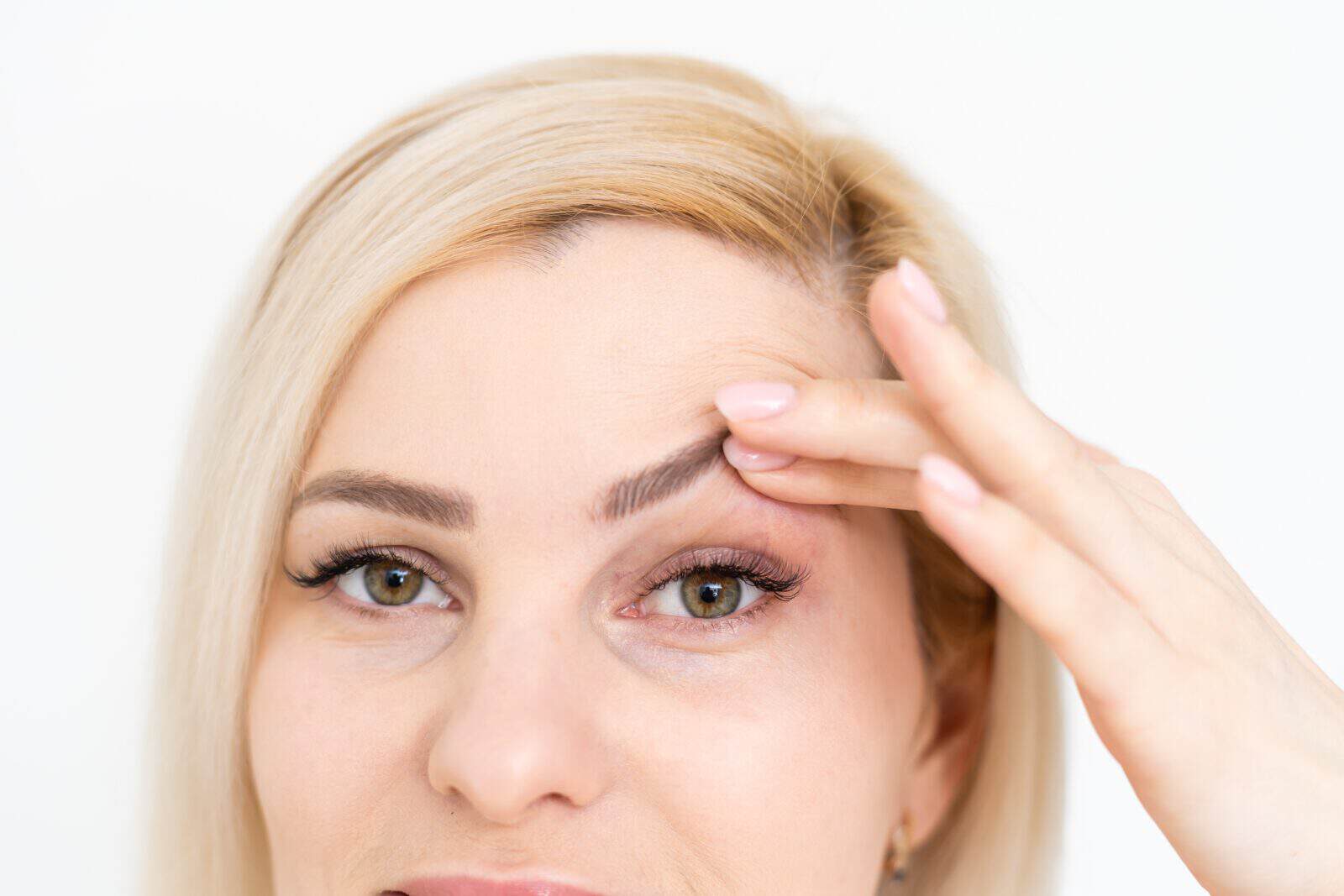 Drooping eyelids