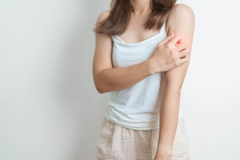 12 subtle signs of lupus many people miss