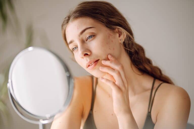 12 Facial signs that may indicate health problems