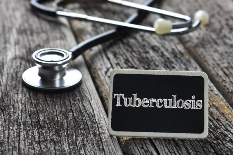 12 things to know about the rise of tuberculosis in the U.S.