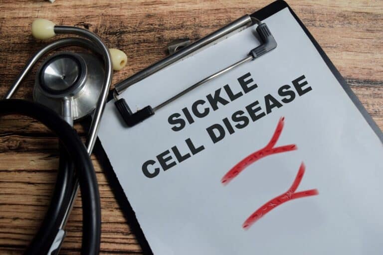 Louisiana patient becomes first in state functionally cured of sickle cell disease