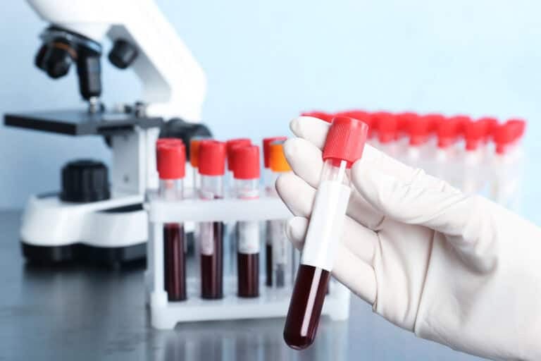 New blood test could help spot aggressive prostate cancer earlier